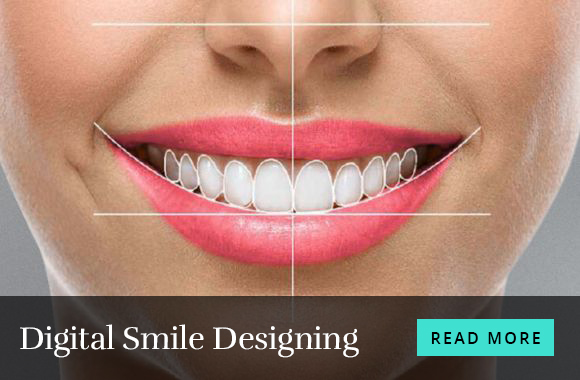 Digital-Smile-Designing