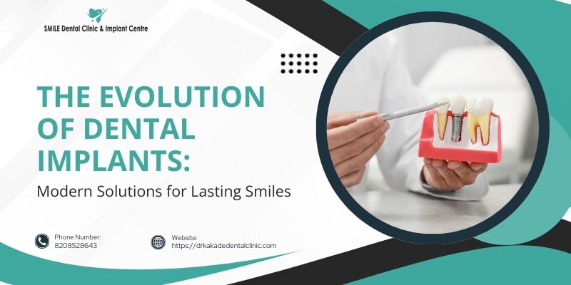 the-evolution-of-dental-implants-modern-solutions-for-lasting-smiles