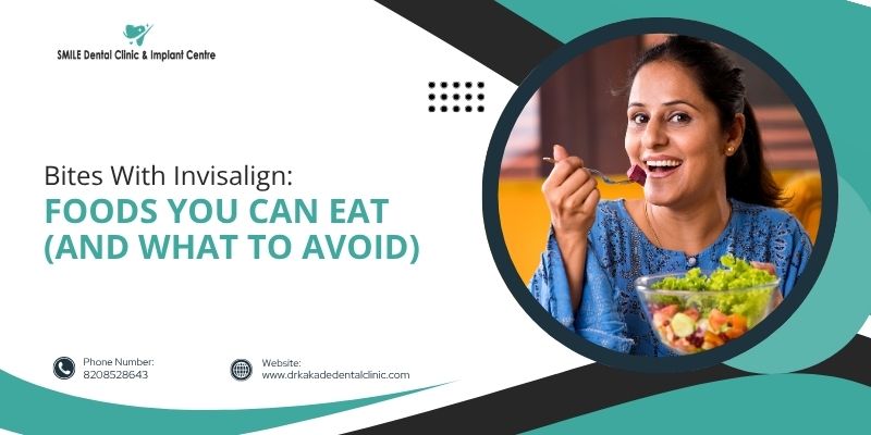 Bites With Invisalign: Foods You Can Eat (And What To Avoid)