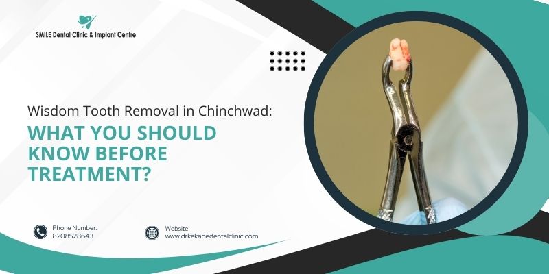 Wisdom Tooth Removal in Chinchwad: What You Should Know Before Treatment?